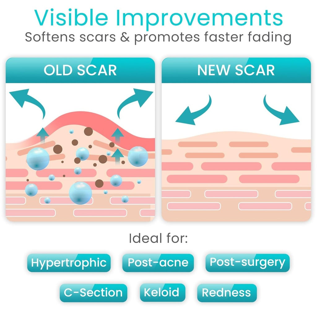 Silicone Scar Tape Vive Care