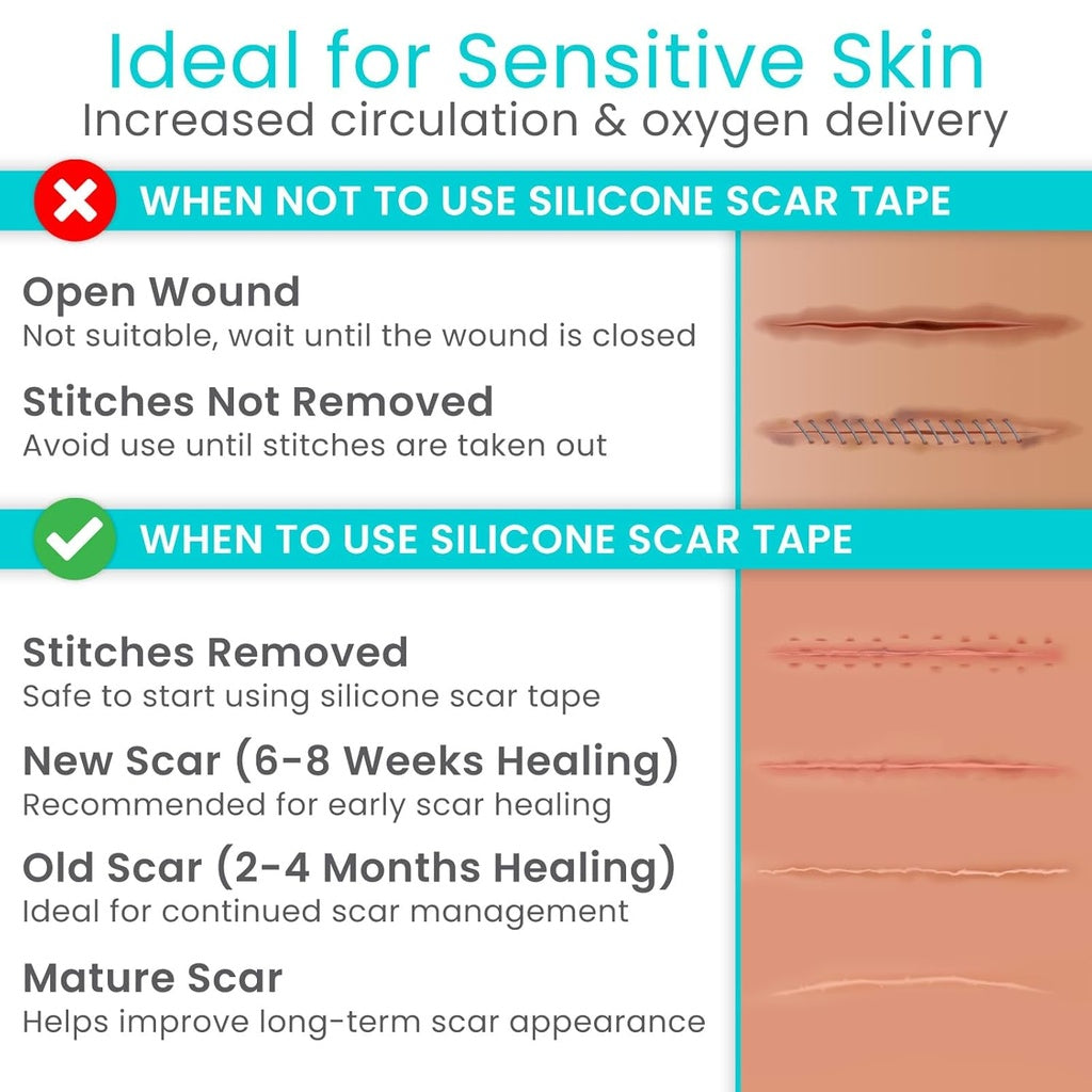 Silicone Scar Tape Vive Care