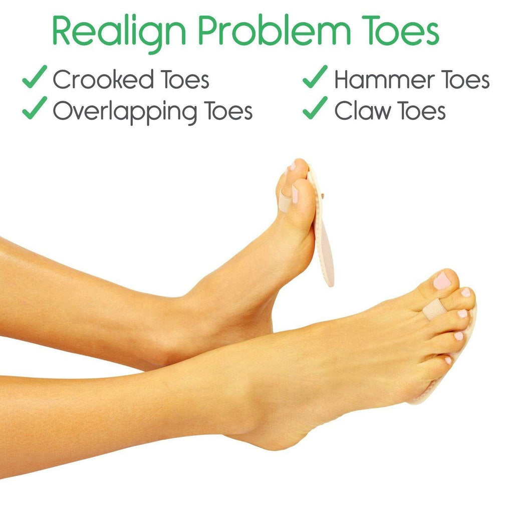 Feet with corrected toe problems on a white background