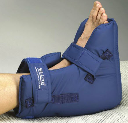 Blue cast on a foot with a neutral background