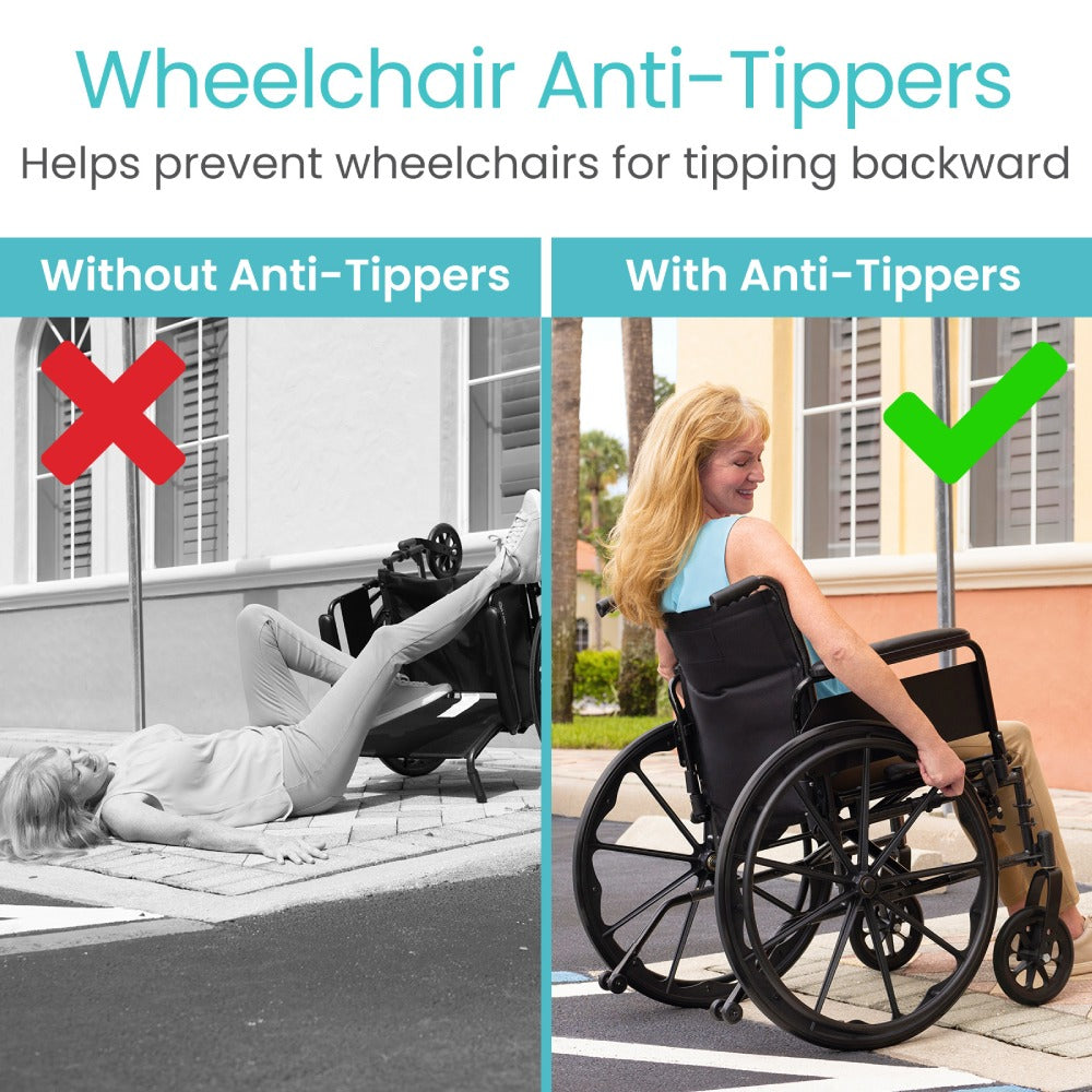 Comparison of a wheelchair tipping backward without anti-tippers and sitting upright with anti-tippers.